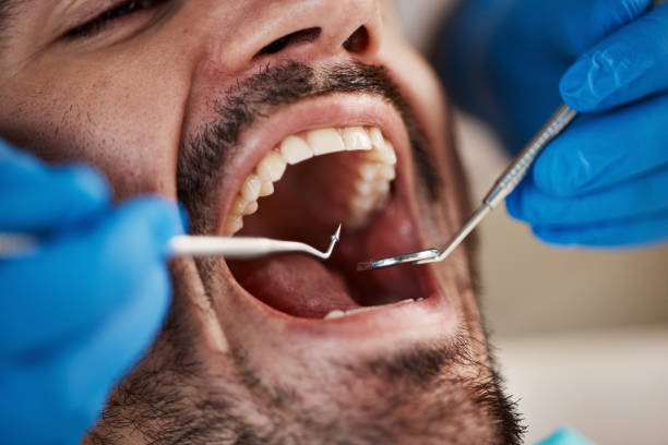 Best Broken or Cracked Tooth Emergency Dentist in Lakewood Clu, MI
