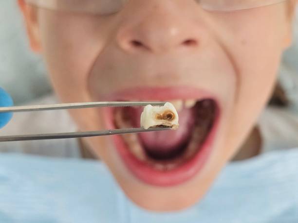Best 24-Hour Emergency Dentist in Lakewood Clu, MI
