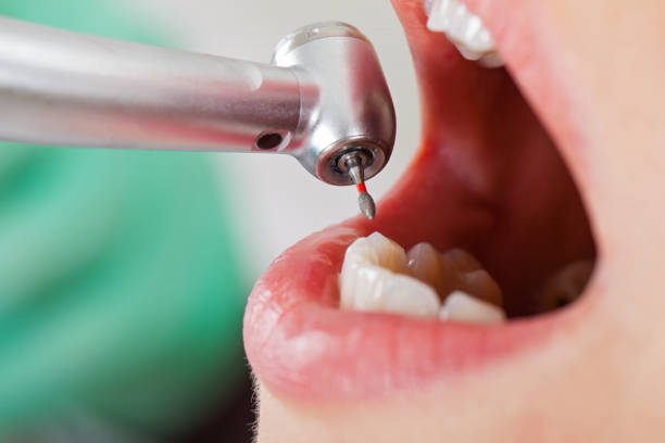 Best Emergency Dental Services for Seniors in Lakewood Clu, MI
